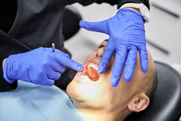 Best Emergency Treatment for Dental Infections or Abscesses in Boulevard Park, WA